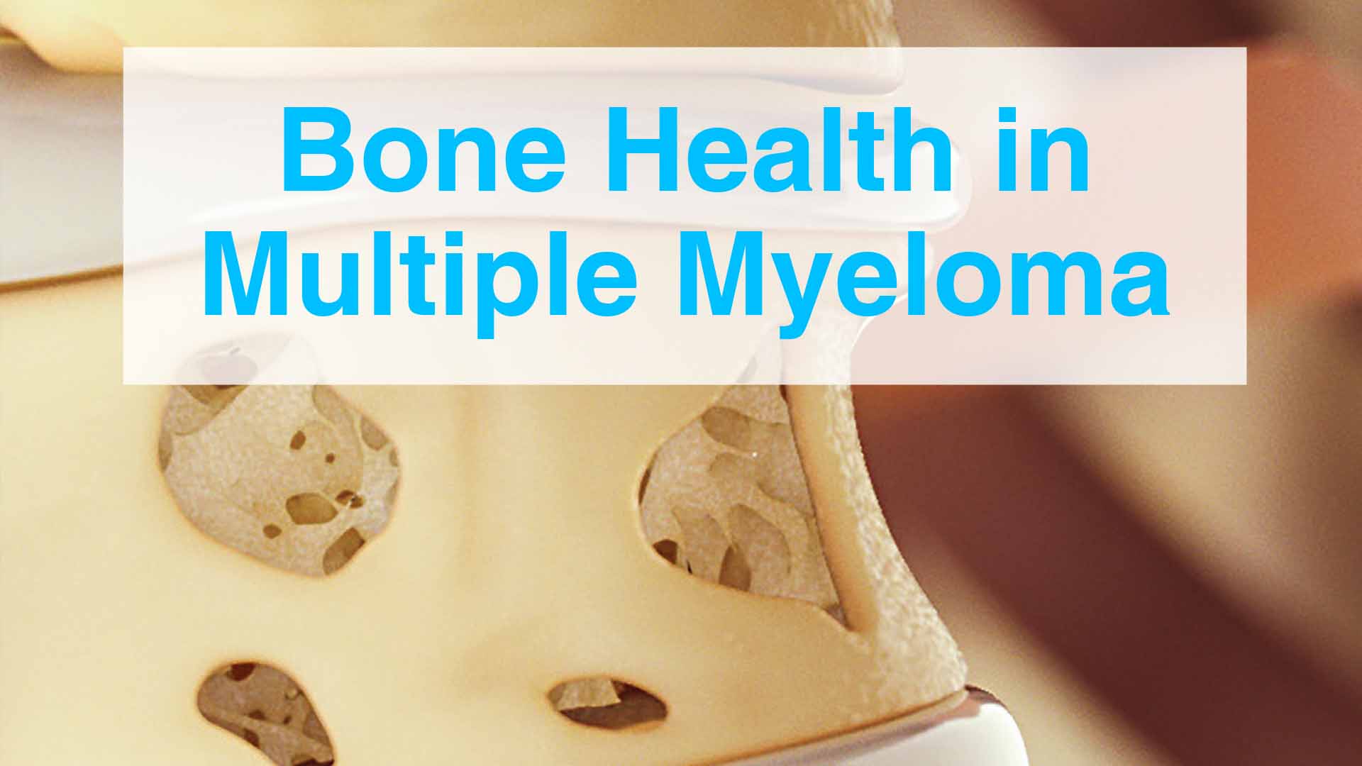 Myeloma Bone Health Brochure